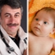 Dr. Komarovsky, neden bebeğin kafasında kabukların olduğu ve onlarla ne yapılacağı hakkında