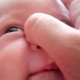 Massage of the lacrimal canal for newborns and infants