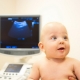 Ultrasound of the brain in newborns and infants
