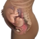 Wat te doen met de baarmoedertint in het derde trimester van de zwangerschap?
