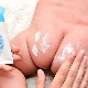 Diaper rash in newborns on and between buttocks