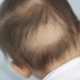 Håret faller ut hos spädbarn: orsakerna och deras eliminering