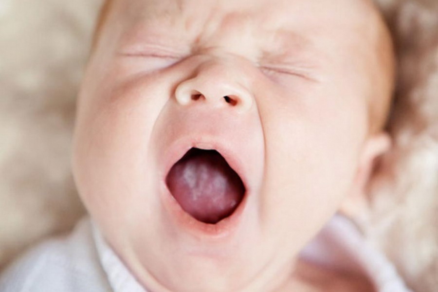 Swollen Gums In Infants 11 Photos How It Looks Naughty Teething
