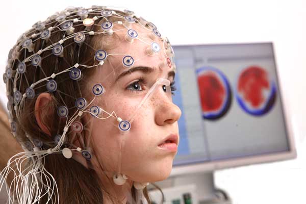 Điện não đồ cho trẻ: điều gì cho thấy hoạt động epileptiform (epiactivity) có nghĩa là gì mà không bị động kinh, giải mã - các chỉ tiêu và nguyên nhân của