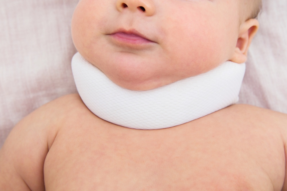علامات صعر في الأطفال حديثي الولادة 13 صور أعراض في الرضع والأطفال في 2 3 أشهر