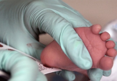 Neonatal screening