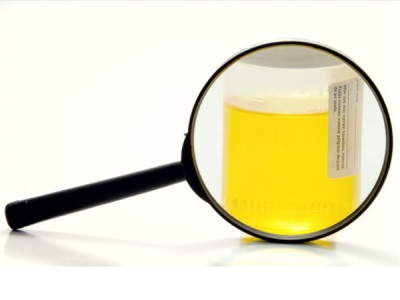 Analyse d'urine
