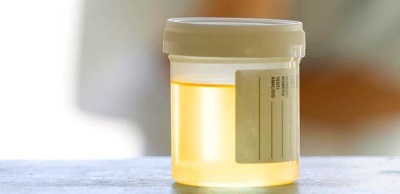 Gele urine is normaal