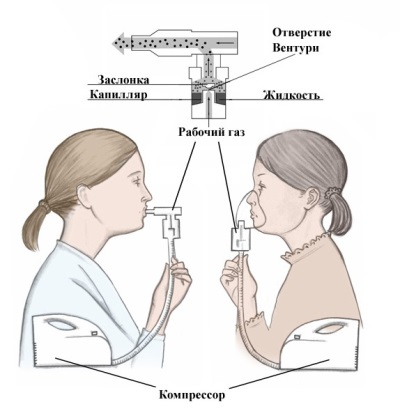 Работа на компресионния инхалатор - схема