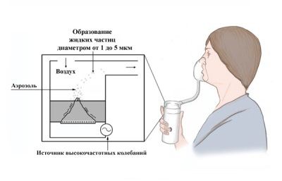 Nebulizzatore a ultrasuoni