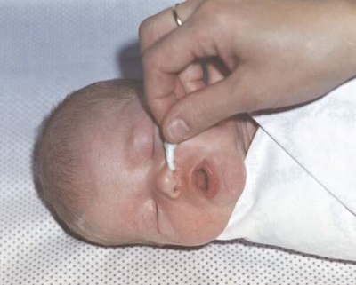 Harness to clean the nose of a newborn