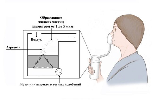 Nebulizers ultrasonik